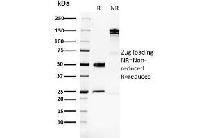 SDS-PAGE (SDS) image for anti-Glucose-6-Phosphate Isomerase (GPI) antibody (ABIN6939548)