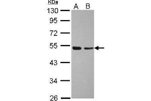WB Image Sample (30 ug of whole cell lysate) A: A431 B: Jurkat 10% SDS PAGE antibody diluted at 1:1000 (TAF7 antibody  (Center))