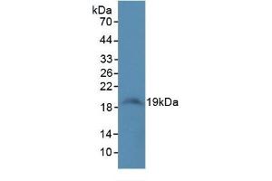 WB of Protein Standard: different control antibody against Highly purified E. (SOD1 ELISA Kit)