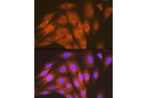 Immunofluorescence analysis of C6 cells using  Rabbit mAb (ABIN7265412) at dilution of 1:100 (40x lens). (ACVRL1 antibody)