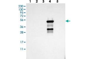 Western blot analysis of Lane 1: RT-4, Lane 2: U-251 MG, Lane 3: Human Plasma, Lane 4: Liver, Lane 5: Tonsil with CYP2C19 polyclonal antibody .