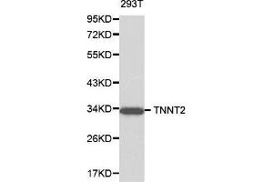 Western blot analysis of 293T cell lysate using TNNT2 antibody. (Cardiac Troponin T2 antibody  (AA 1-120))
