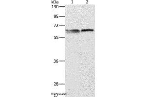 Western blot analysis of 293T and Jurkat cell, using ALAS2 Polyclonal Antibody at dilution of 1:1000 (ALAS2 antibody)