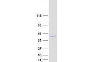 Western Blotting (WB) image for Modulator of Apoptosis 1 (MOAP1) protein (Myc-DYKDDDDK Tag) (ABIN2726190)