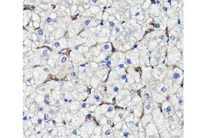 Immunohistochemistry of paraffin-embedded Human liver using COMP Polyclonal Antibody at dilution of 1:100 (40x lens). (COMP antibody)