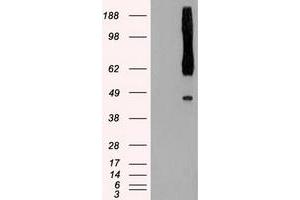 Western Blotting (WB) image for anti-RAD9 Homolog A (S. Pombe) (RAD9A) antibody (ABIN1500581) (RAD9A antibody)