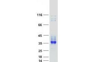 Validation with Western Blot (SCN4B Protein (Transcript Variant 1) (Myc-DYKDDDDK Tag))