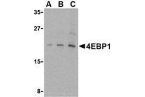 Western blot analysis of AP30001PU-N 4E-BP1 antibody in 3T3 cell lysate with 4E-BP1 antibody at (A) 2.