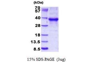 SDS-PAGE (SDS) image for Ets Homologous Factor (EHF) (AA 1-300) protein (His tag) (ABIN5852935) (EHF Protein (AA 1-300) (His tag))