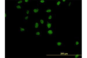 Immunofluorescence of monoclonal antibody to CSE1L on HeLa cell. (Exportin 2 antibody  (AA 872-971))