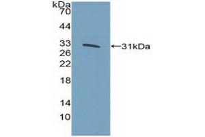 Detection of Recombinant KLF5, Human using Polyclonal Antibody to Kruppel Like Factor 5, Intestinal (KLF5) (KLF5 antibody  (AA 216-457))