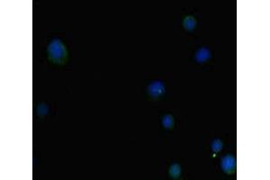 Immunofluorescent analysis of MCF-7 cells using ABIN7155286 at dilution of 1: 100 and Alexa Fluor 488-congugated AffiniPure Goat Anti-Rabbit IgG(H+L) (PTGER3 antibody  (AA 2283-2414))