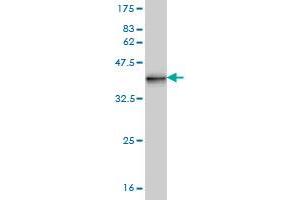 Western Blotting (WB) image for anti-KiSS-1 Metastasis-Suppressor (KISS1) (AA 46-145) antibody (ABIN517344)