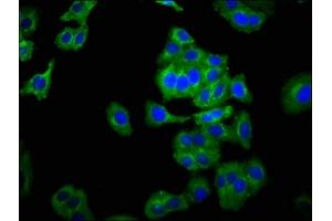 Immunofluorescence staining of HepG2 cells with ABIN7161195 at 1:266, counter-stained with DAPI. (NCAM2 antibody  (AA 209-333))