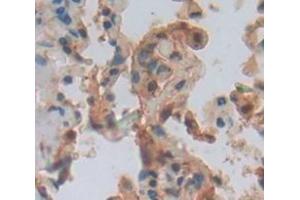 IHC-P analysis of Human Tissue, with DAB staining. (ARHGDIB antibody  (AA 2-201))