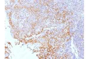 Formalin-fixed, paraffin-embedded human Tonsil stained with Beta-Catenin (p120) Monoclonal Antibody (5H10). (CTNNB1 antibody  (C-Term))