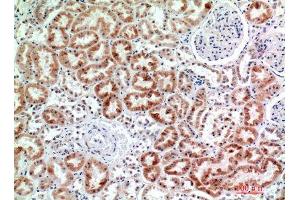 Immunohistochemistry (IHC) analysis of paraffin-embedded Human Kidney, antibody was diluted at 1:200.