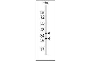 Western blot analysis of FBXO4 Antibody (Center) in Y79 cell line lysates (35ug/lane).