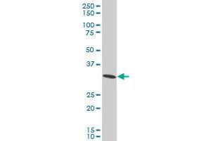 RPS3A polyclonal antibody (A01), Lot # ONW0060316QCS1 Western Blot analysis of RPS3A expression in HeLa .