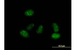 Immunofluorescence of purified MaxPab antibody to ALS2CR15 on HeLa cell. (ICA1L antibody  (AA 1-482))