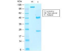 SDS-PAGE Analysis of Purified AIF1/IBA1 Mouse Recombinant Monoclonal Antibody ABIN6383787. (Recombinant Iba1 antibody)