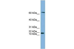 WB Suggested Anti-GM2A Antibody Titration:  0. (GM2A antibody  (N-Term))