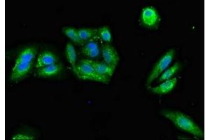 Immunofluorescent analysis of HepG2 cells using ABIN7146620 at dilution of 1:100 and Alexa Fluor 488-congugated AffiniPure Goat Anti-Rabbit IgG(H+L) (PRKAR2A antibody  (Regulatory Subunit))