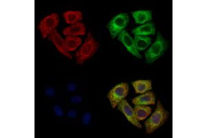 ABIN6260562 and ABIN6272683 staining Hela cells by IF/ICC.