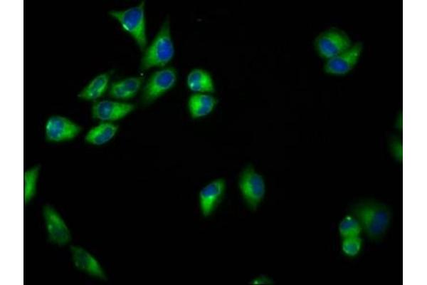 SEMA6B antibody  (AA 756-888)