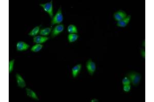 Immunofluorescence staining of Hela cells with ABIN7168823 at 1:33, counter-stained with DAPI. (SEMA6B antibody  (AA 756-888))