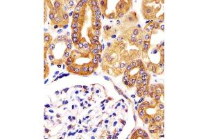(ABIN6244121 and ABIN6578389) staining VAC14 in human kidney tissue sections by Immunohistochemistry (IHC-P - paraformaldehyde-fixed, paraffin-embedded sections). (VAC14 antibody  (AA 125-159))