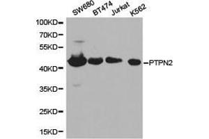 Western Blotting (WB) image for anti-Protein tyrosine Phosphatase, Non-Receptor Type 2 (PTPN2) antibody (ABIN1874450) (PTPN2 antibody)