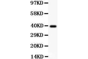 Anti-Collagen IV Picoband antibody,  All lanes: Anti Collagen IV  at 0. (COL4A1 antibody  (AA 1445-1669))