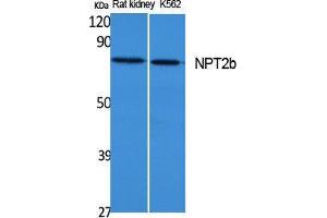 Western Blotting (WB) image for anti-Solute Carrier Family 34 (Sodium Phosphate), Member 2 (SLC34A2) (C-Term) antibody (ABIN3187660) (SLC34A2 antibody  (C-Term))