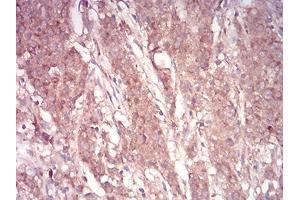 Immunohistochemistry (IHC) image for anti-ADP-Ribosylation Factor 1 (ARF1) (AA 76-182) antibody (ABIN5542481)