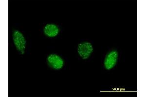 Immunofluorescence of purified MaxPab antibody to VIM on HeLa cell.