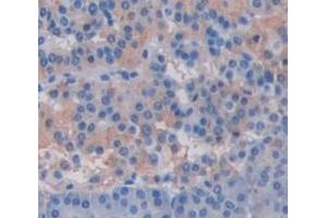 #VALUE! (CRISP3 antibody  (AA 21-243))