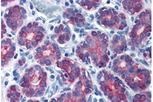 Human Breast (formalin-fixed, paraffin-embedded) stained with KRT7 antibody ABIN337389 at 10 ug/ml followed by biotinylated goat anti-rabbit IgG secondary antibody ABIN481713, alkaline phosphatase-streptavidin and chromogen. (Cytokeratin 7 antibody  (N-Term))