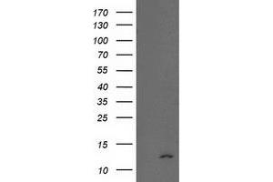 Western Blotting (WB) image for anti-NADH Dehydrogenase (Ubiquinone) 1 alpha Subcomplex, 7, 14.5kDa (NDUFA7) antibody (ABIN1499659)