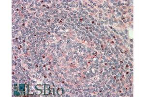 ABIN940552 (5µg/ml) staining of paraffin embedded Human Tonsil. (CTDSP1 antibody  (Internal Region))