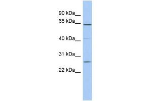 WB Suggested Anti-FAM71B Antibody Titration: 0.
