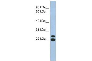 C19ORF54 antibody used at 1 ug/ml to detect target protein. (C19orf54 antibody  (N-Term))