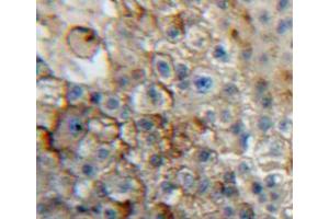 Used in DAB staining on fromalin fixed paraffin-embedded liver tissue (CD101 antibody  (AA 566-784))