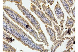 IHC analysis of RET using anti-RET antibody (ABIN6719502). (Ret Proto-Oncogene antibody  (AA 29-304))