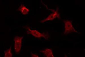 ABIN6266665 staining COS7 by IF/ICC. (TRADD antibody)