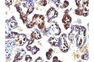 Formalin-fixed, paraffin-embedded human placenta stained with CD34 antibody (QBEnd/10 + HPCA1/763) (CD34 antibody)