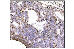IHC analysis of NDEL1 using anti-NDEL1 antibody (ABIN7602511).