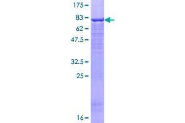 UBR2 Protein (AA 1-439) (GST tag)