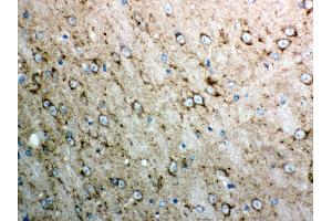 Immunohistochemistry (IHC) image for anti-Cytochrome C, Somatic (CYCS) (AA 2-105) antibody (ABIN3042783)