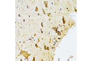 Immunohistochemistry (Paraffin-embedded Sections) (IHC (p)) image for anti-Ribosomal Protein L13 (RPL13) (AA 1-211) antibody (ABIN6147109)